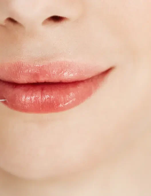 Should You Follow the Lip Filler Trend? Read This Before You Decide