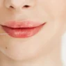 Should You Follow the Lip Filler Trend? Read This Before You Decide