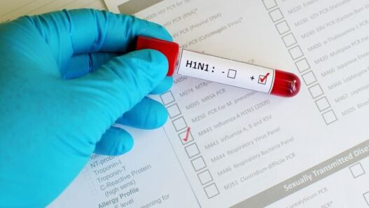 H1N1 Is On The Rise: Food, Fitness & Wellness Tips