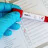 H1N1 Is On The Rise: Food, Fitness & Wellness Tips